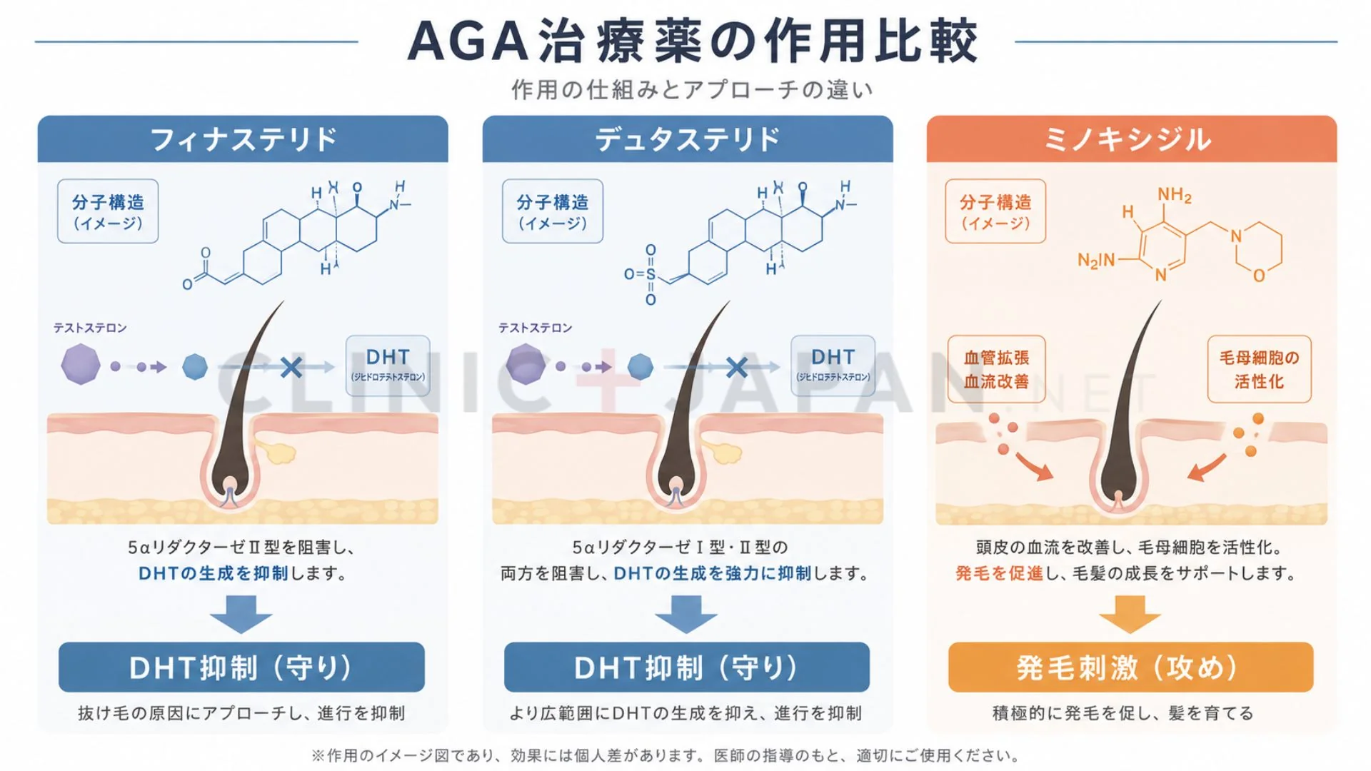 AGA治療薬の作用機序比較 — フィナステリド・デュタステリド・ミノキシジルの効き方マップ