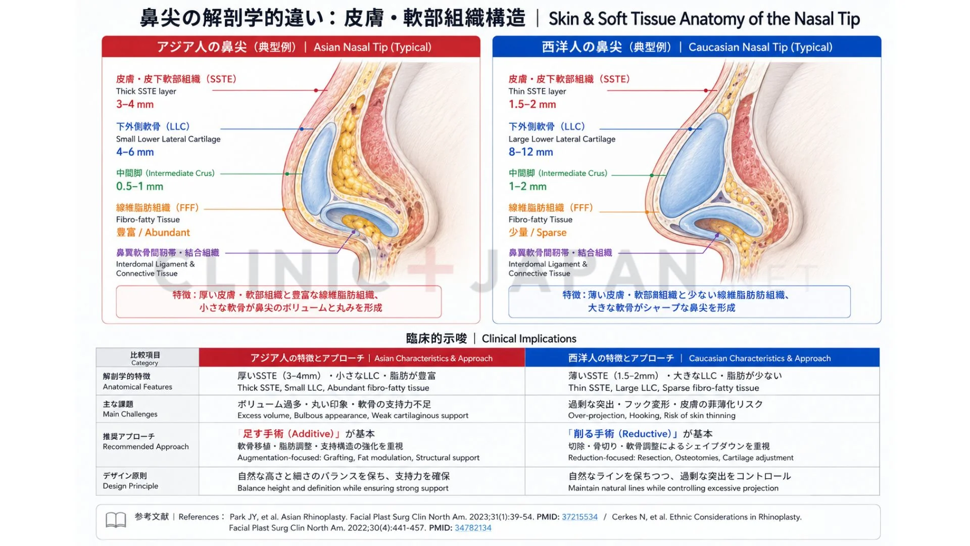 アジア人と西洋人の鼻先解剖比較 — 皮膚厚・軟骨量・SSTEの違いと鼻尖形成への影響