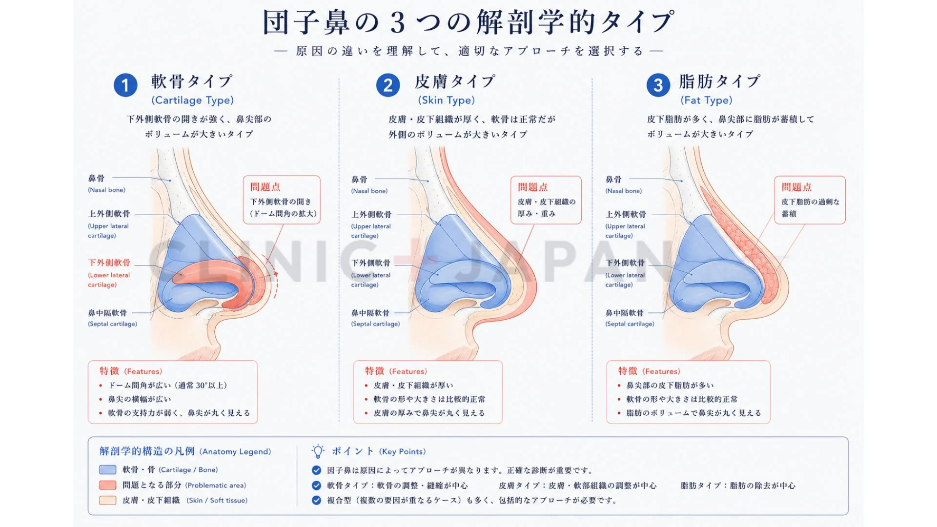 団子鼻の3タイプ — 軟骨・皮膚・脂肪の解剖学的違い