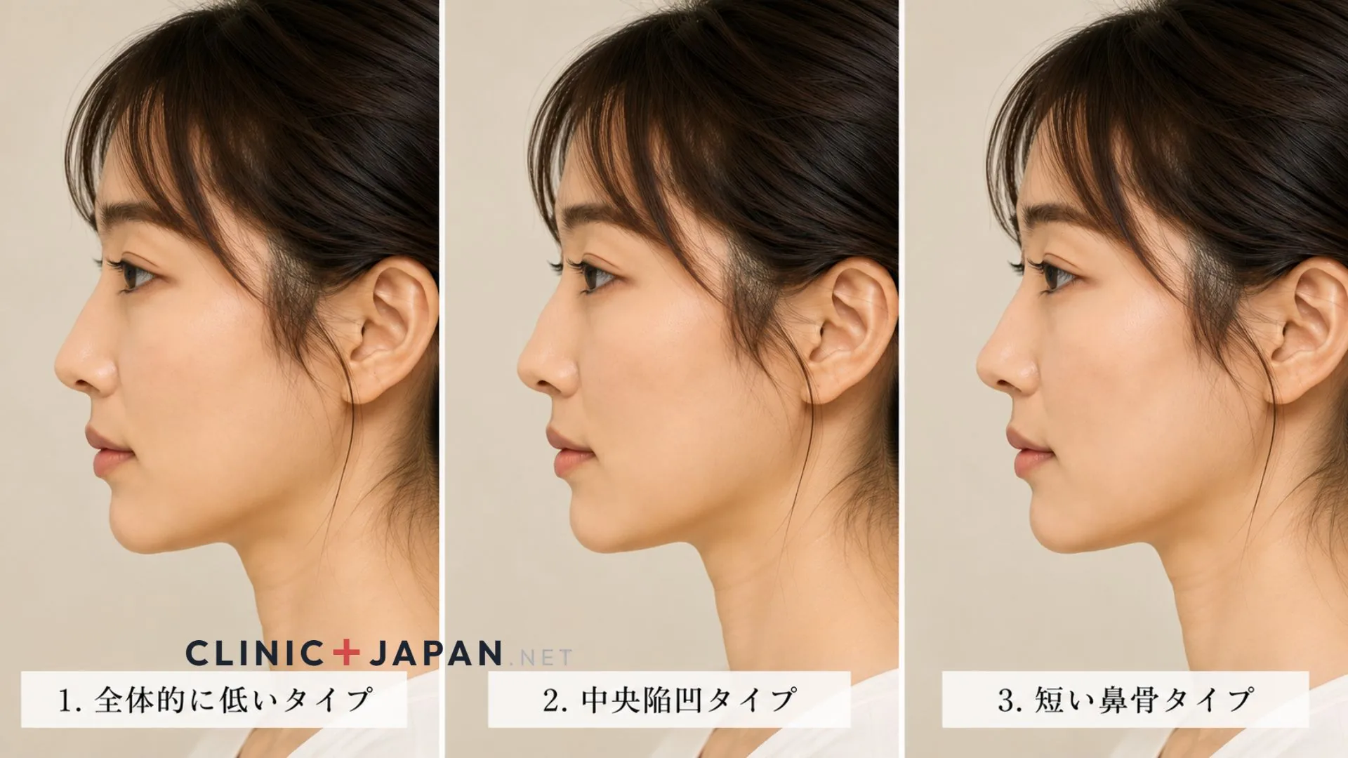 鼻根（びこん）が低い