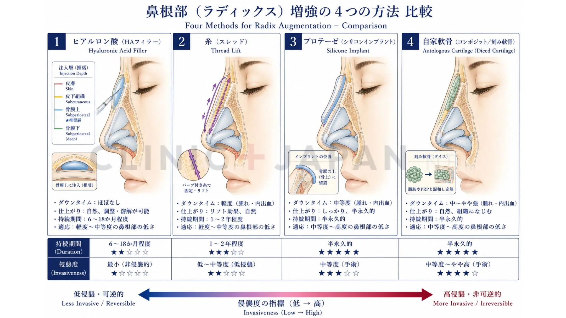 鼻根を上げる4つの方法 — ヒアル・糸・プロテーゼ・自家軟骨の比較