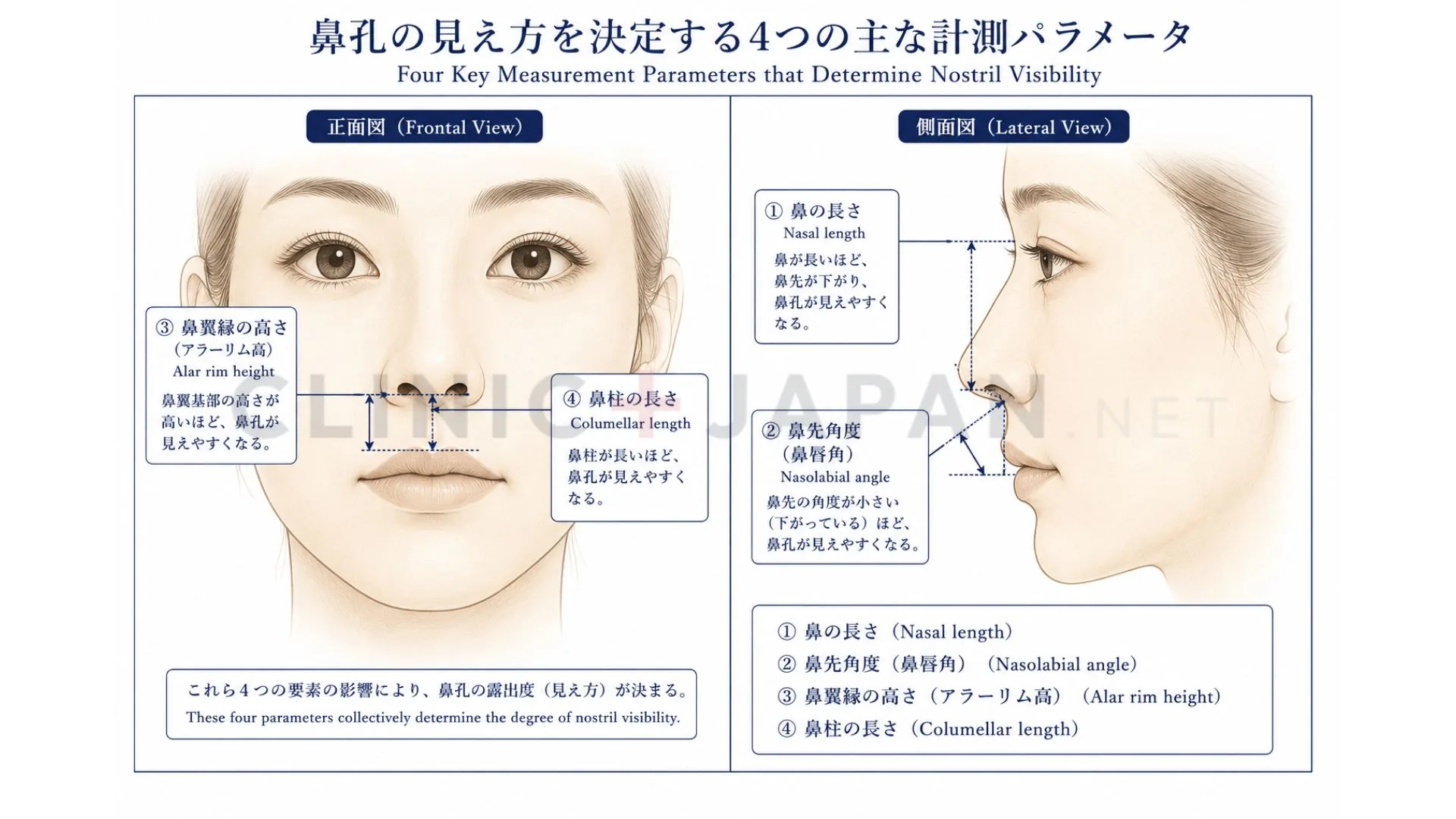 鼻の穴が見える4つの解剖学的要因 — 鼻長・鼻先角度・鼻翼縁高さ・鼻柱長