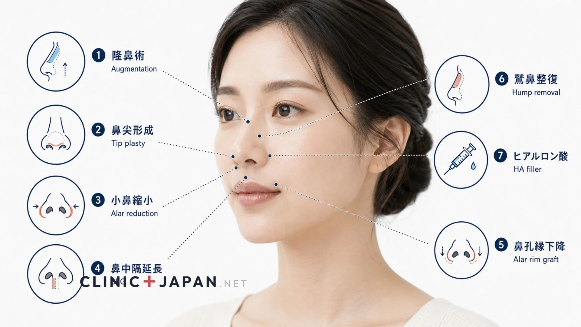 鼻整形の種類