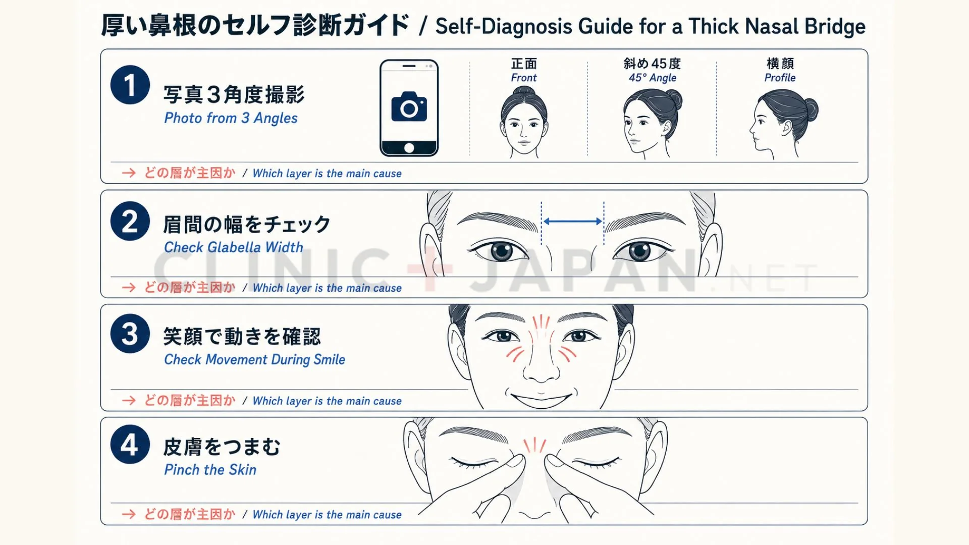 太い鼻筋の原因を見分ける自己診断チャート