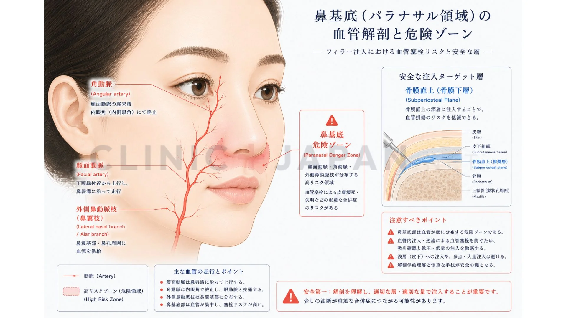 鼻基底の解剖図 — 顔面動脈分枝と注入危険ゾーン