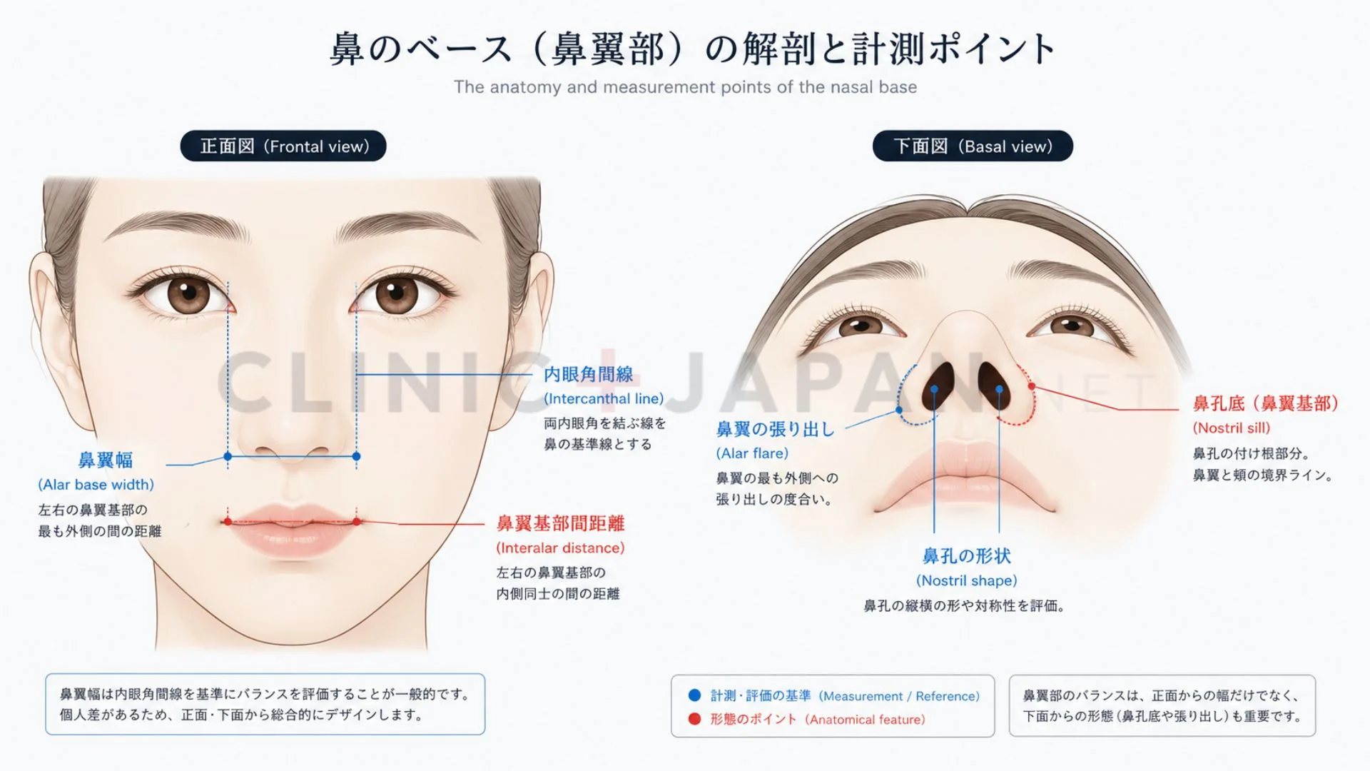 小鼻の解剖図 — 鼻翼幅・鼻孔径・alar flareの違いと術式の対応