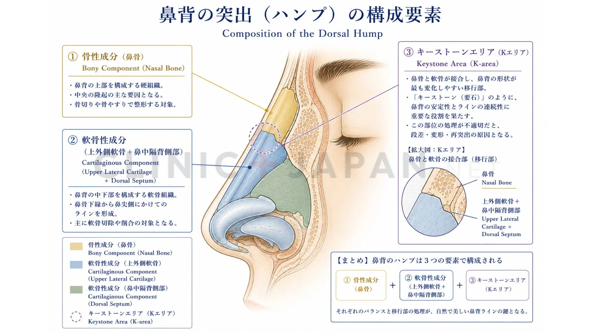 鷲鼻の解剖図 — 骨成分・軟骨成分・キーストーン領域の構造