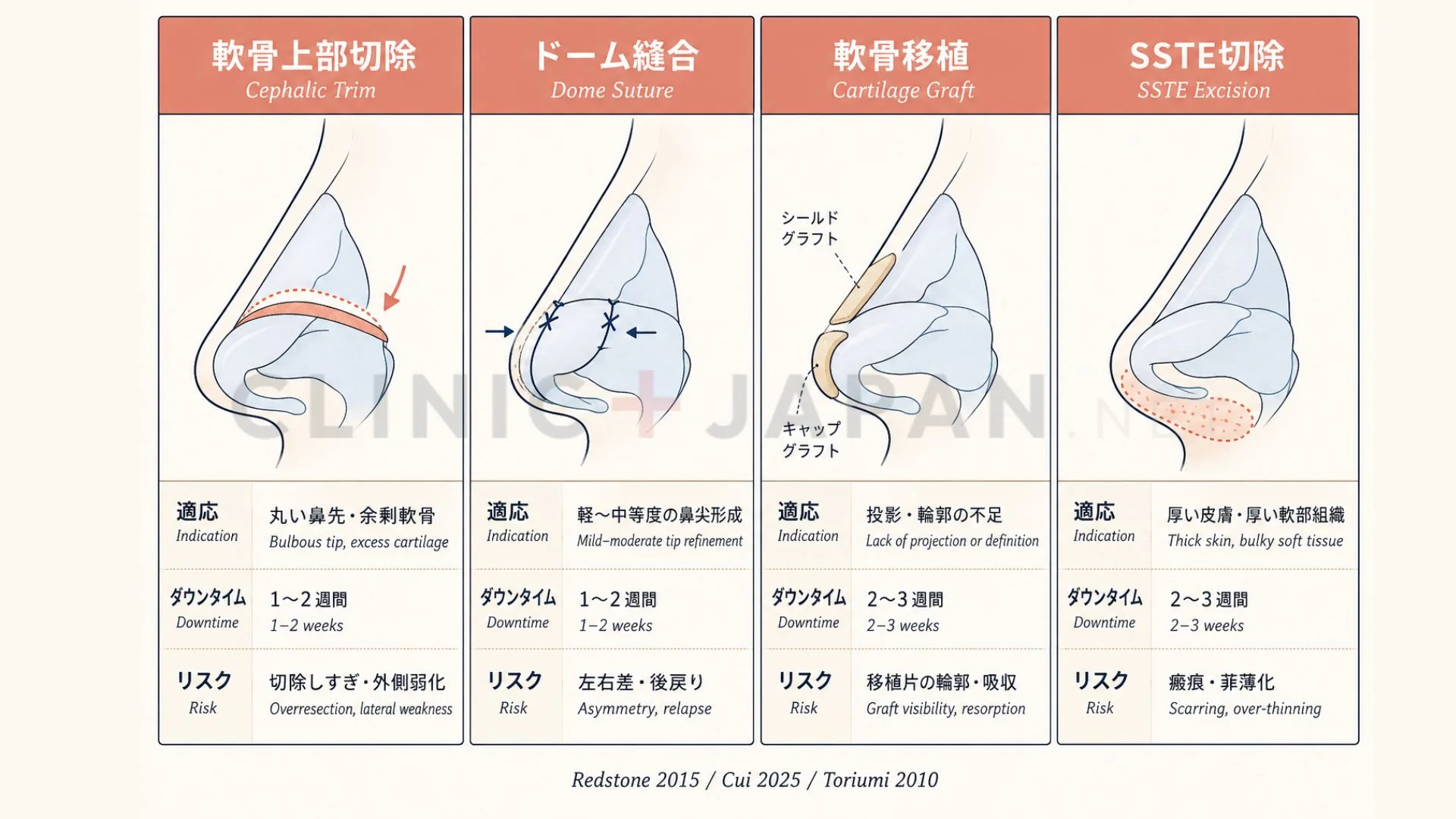 矢印鼻の4つの治療アプローチ一覧