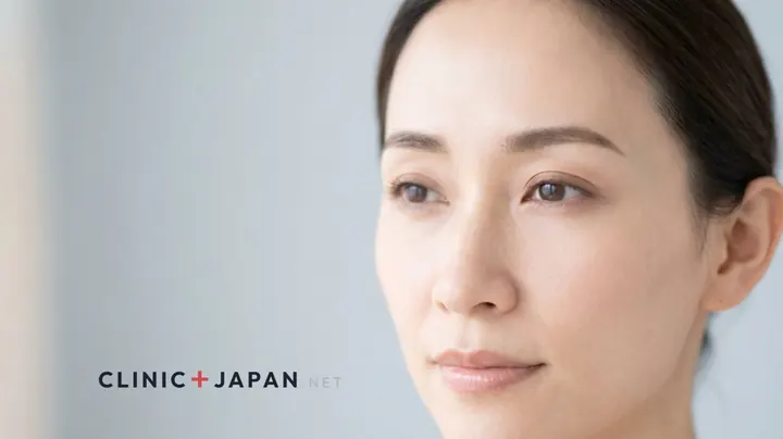 眉間ボトックスの効果