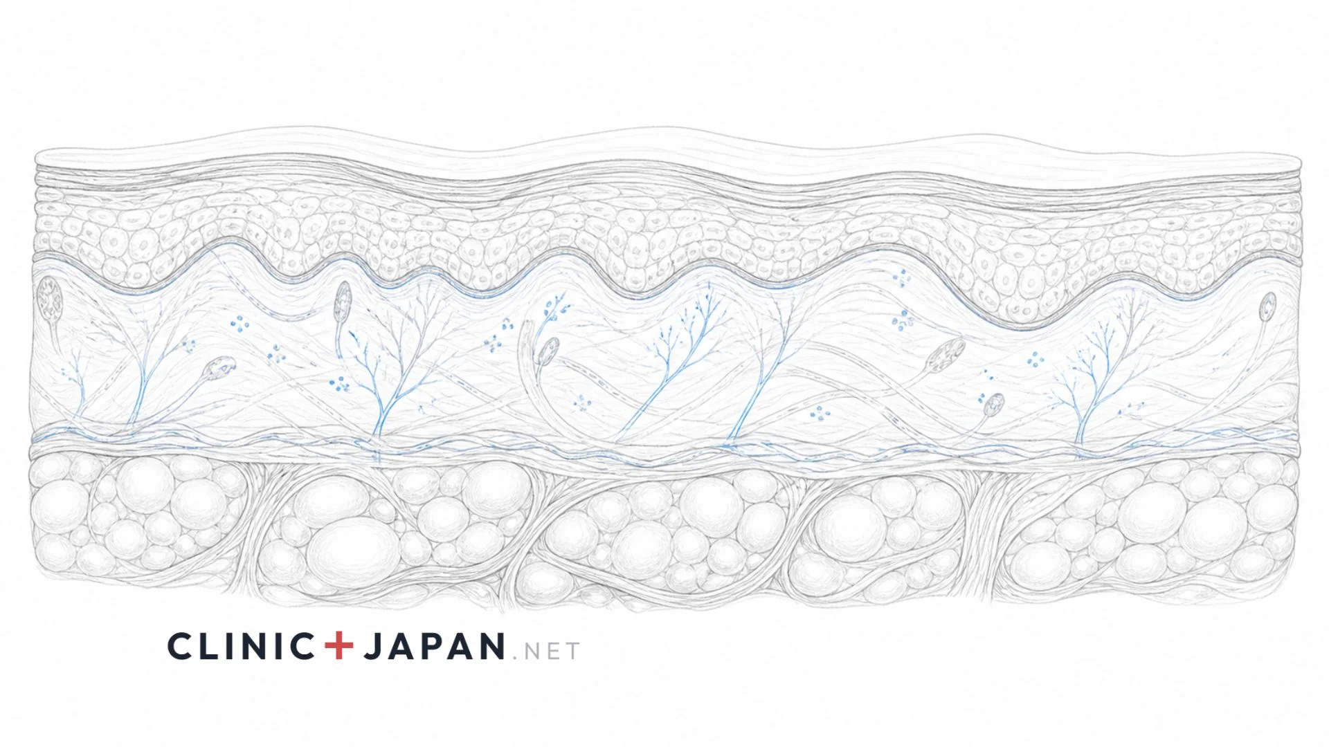 ダーマペンの失敗パターンと色素沈着の発生要因