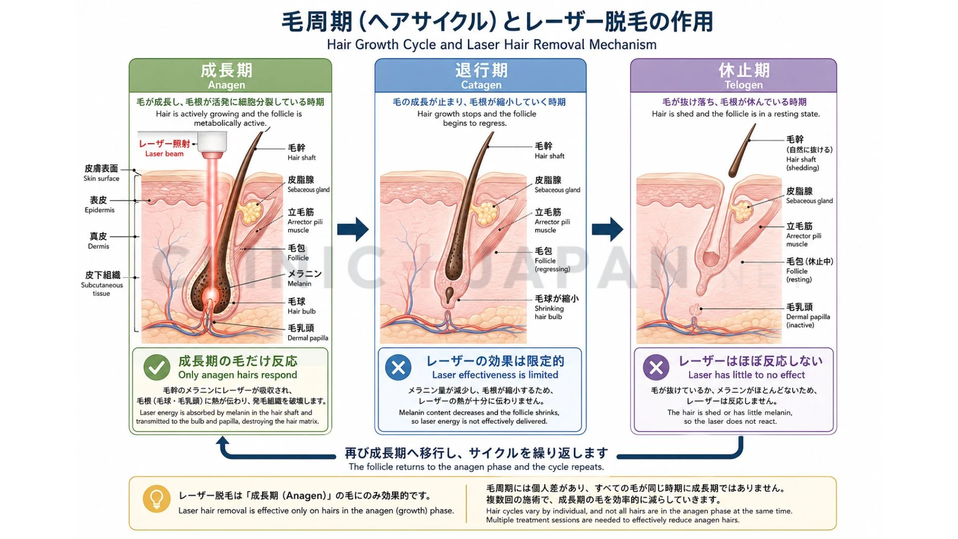ゴール別の必要回数と総額の関係を示した比較図（自己処理が楽・ほぼ不要・ツルツル）